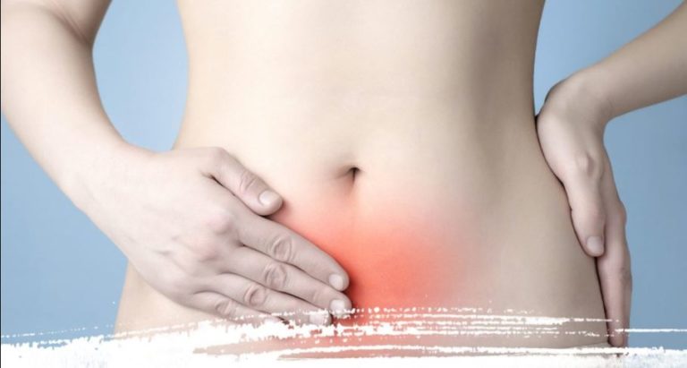 Endometriose